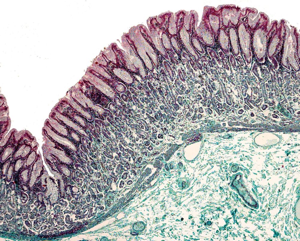 Australian Biostain - a CSA Pathology brand